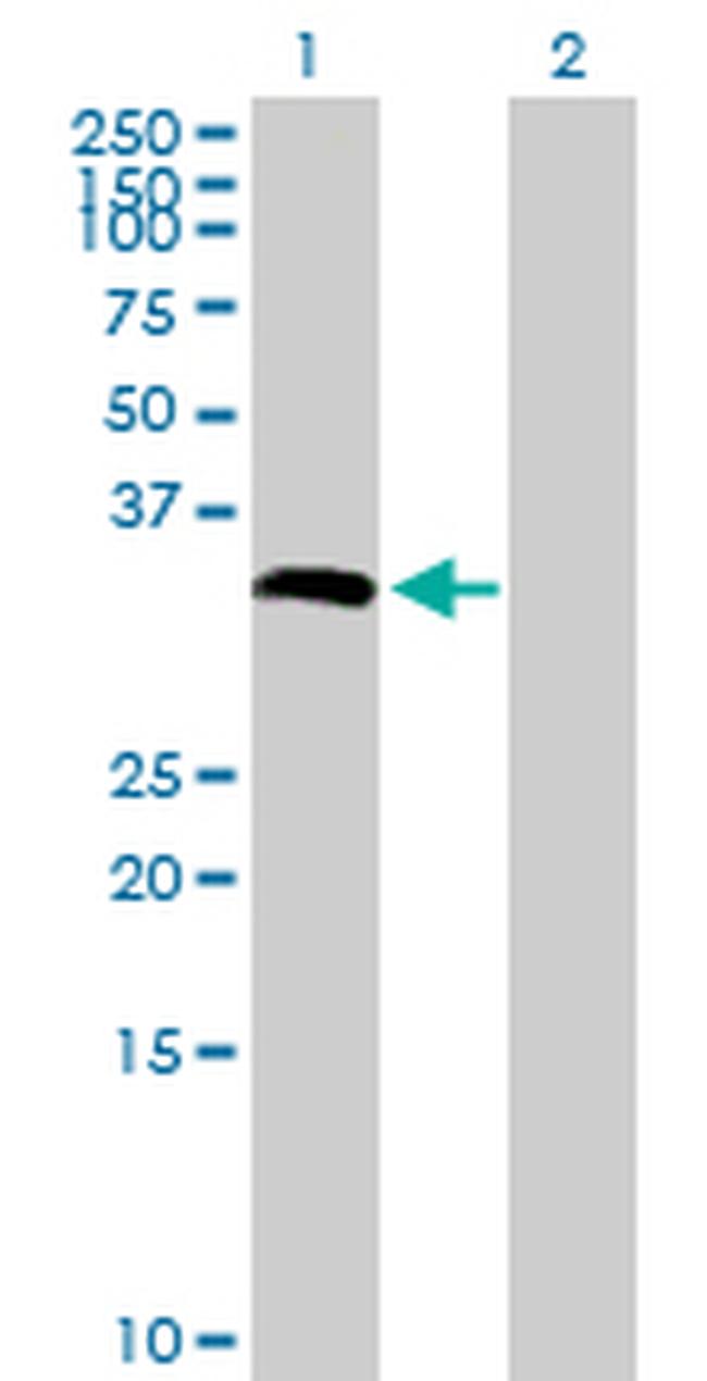 CYB5R1 Antibody in Western Blot (WB)