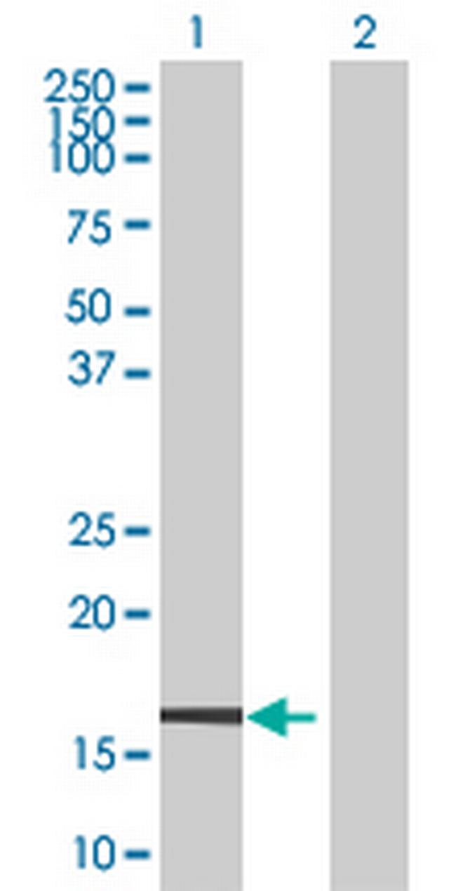ZNF44 Antibody in Western Blot (WB)