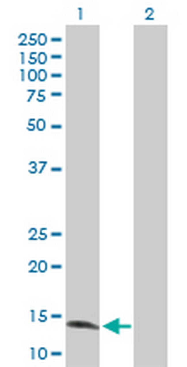 ZNF44 Antibody in Western Blot (WB)