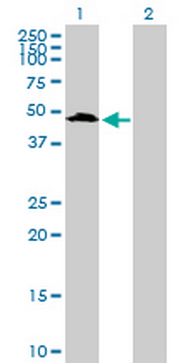 UIMC1 Antibody in Western Blot (WB)