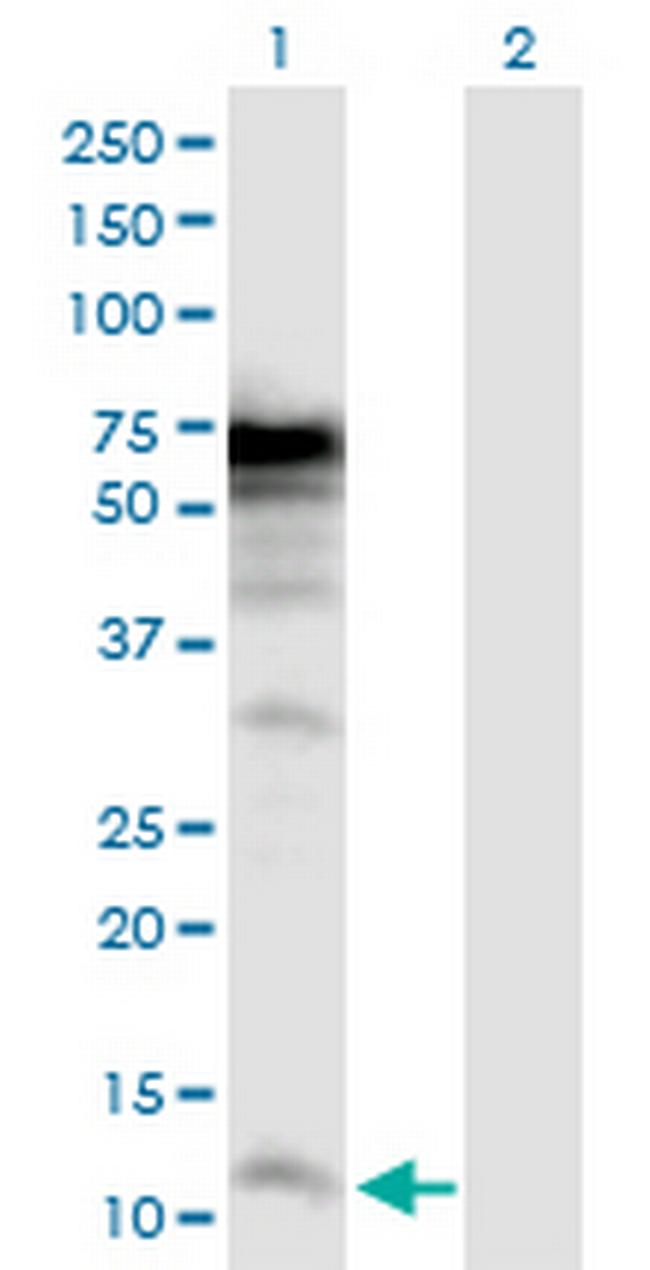 POLR3K Antibody in Western Blot (WB)