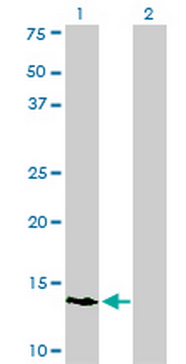 POLR3K Antibody in Western Blot (WB)