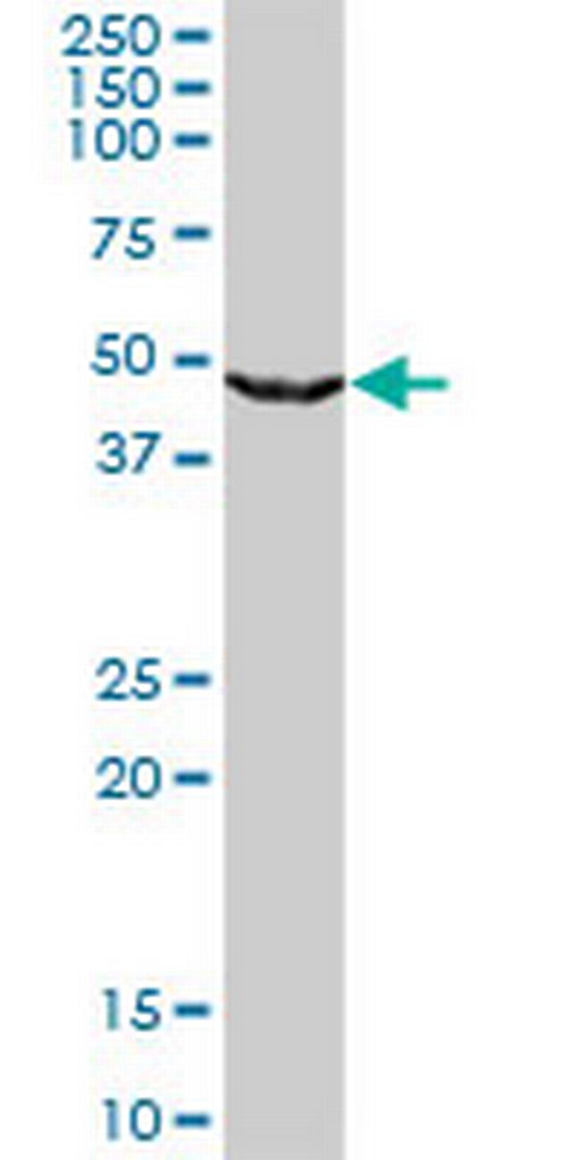 UPB1 Antibody in Western Blot (WB)