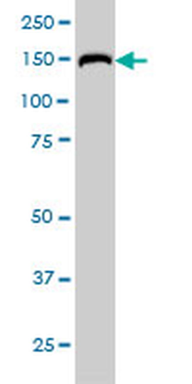 RAPGEF6 Antibody in Western Blot (WB)