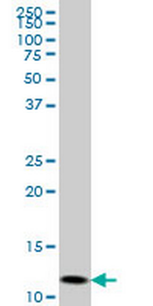 GHRL Antibody in Western Blot (WB)