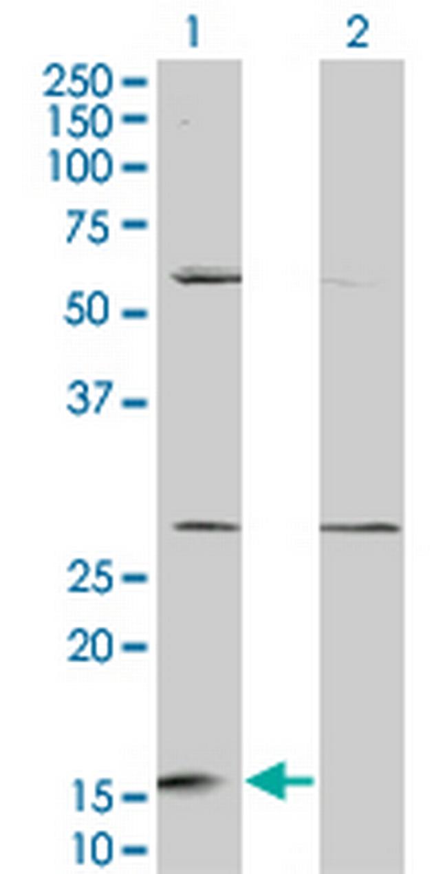 GHRL Antibody in Western Blot (WB)