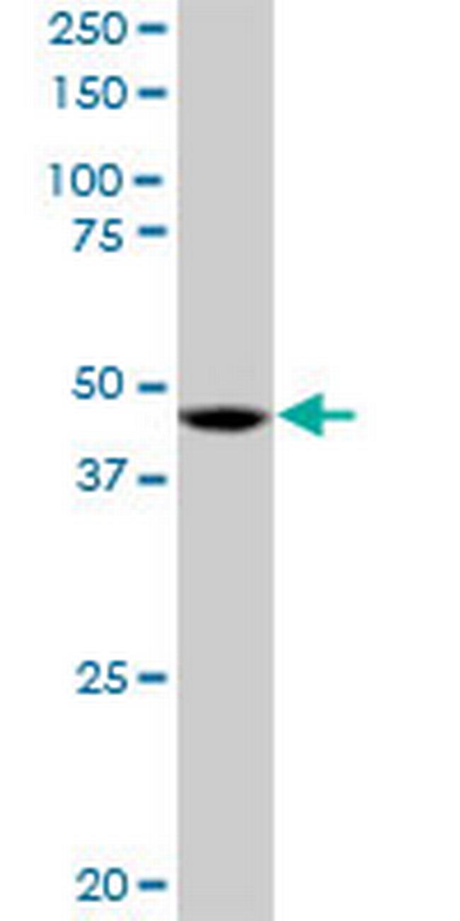 RP6-213H19.1 Antibody in Western Blot (WB)