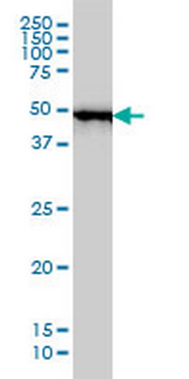 RP6-213H19.1 Antibody in Western Blot (WB)