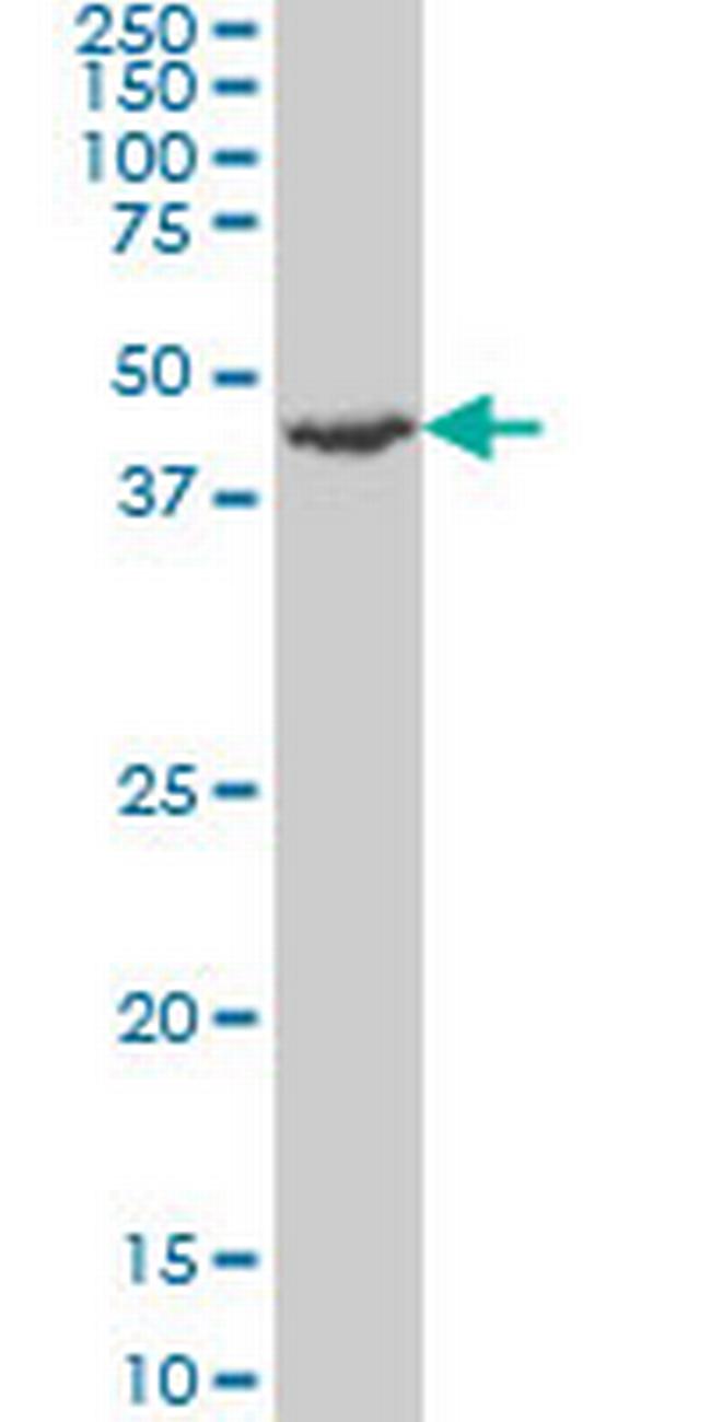 RP6-213H19.1 Antibody in Western Blot (WB)