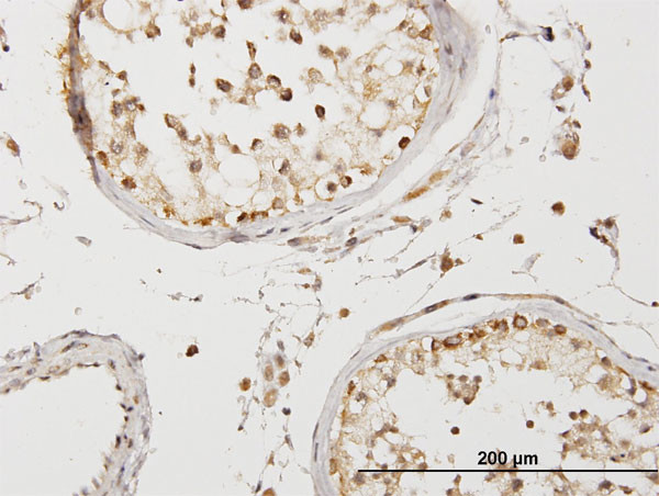 COQ3 Antibody in Immunohistochemistry (Paraffin) (IHC (P))