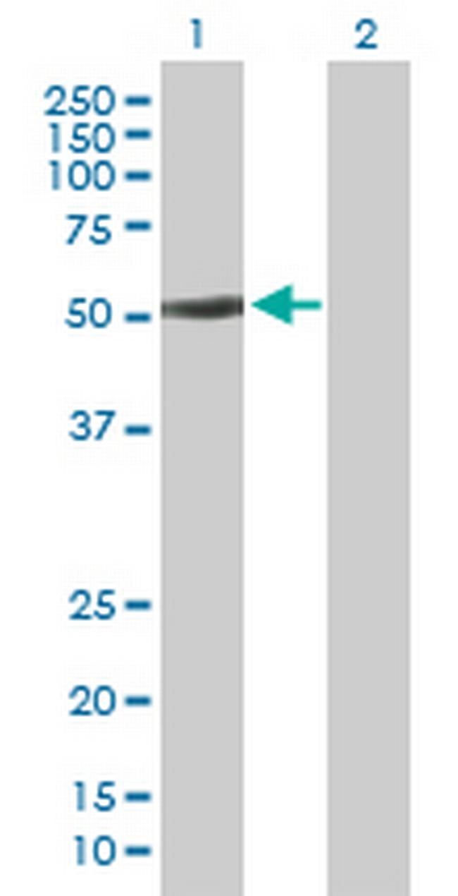 BTBD1 Antibody in Western Blot (WB)