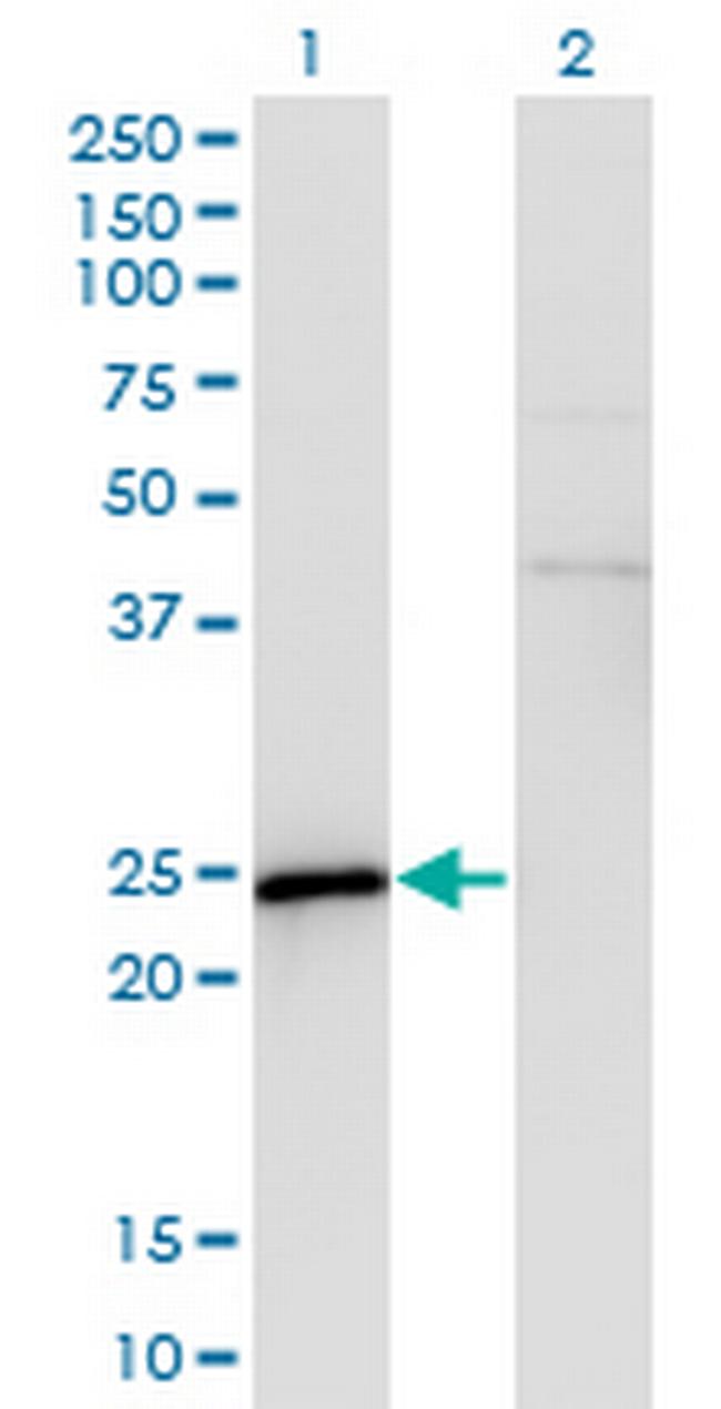SPA17 Antibody in Western Blot (WB)
