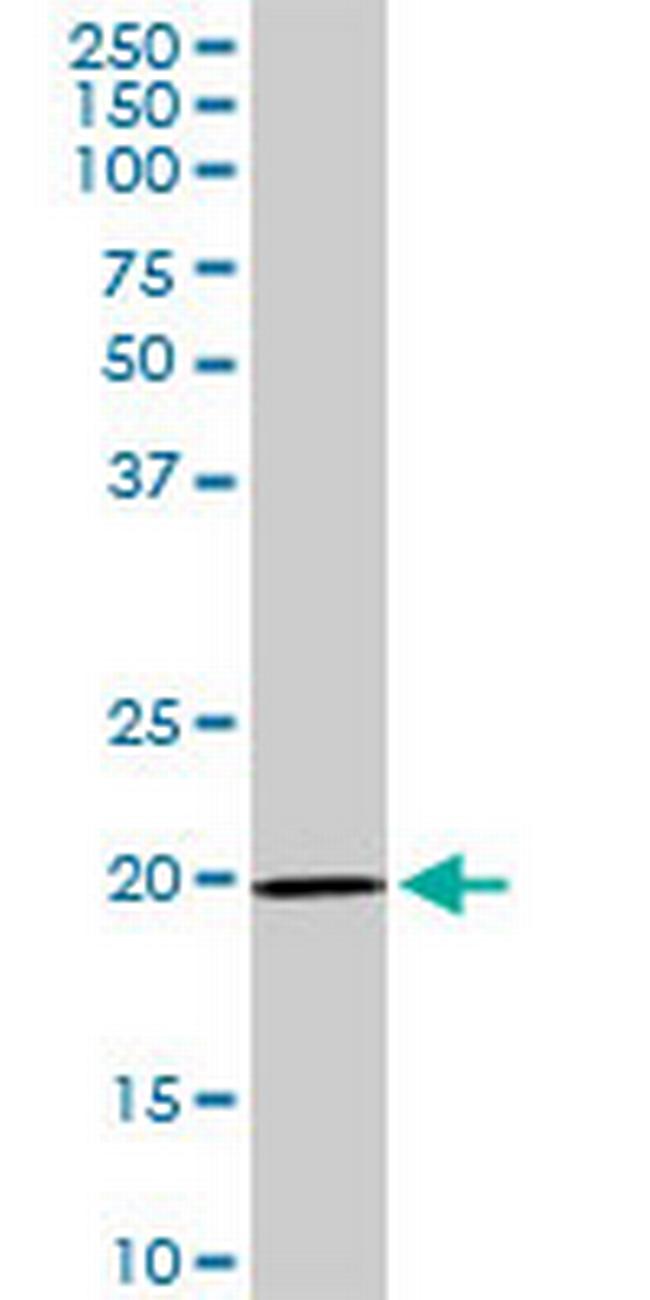 IL17D Antibody in Western Blot (WB)