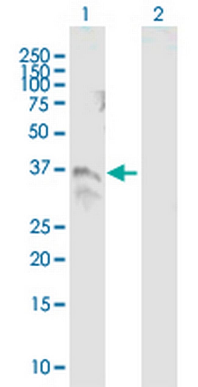 TM6SF2 Antibody in Western Blot (WB)