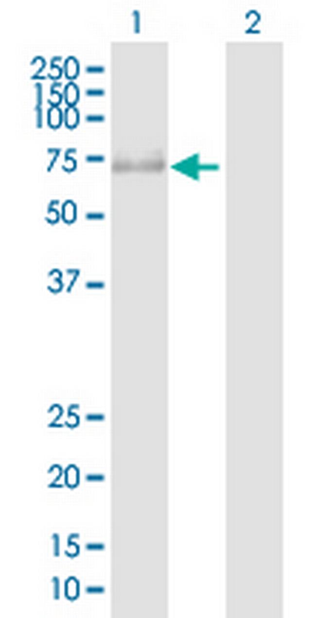 PRKAG3 Antibody in Western Blot (WB)