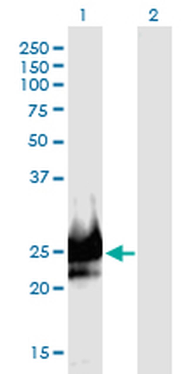 DSCR6 Antibody in Western Blot (WB)