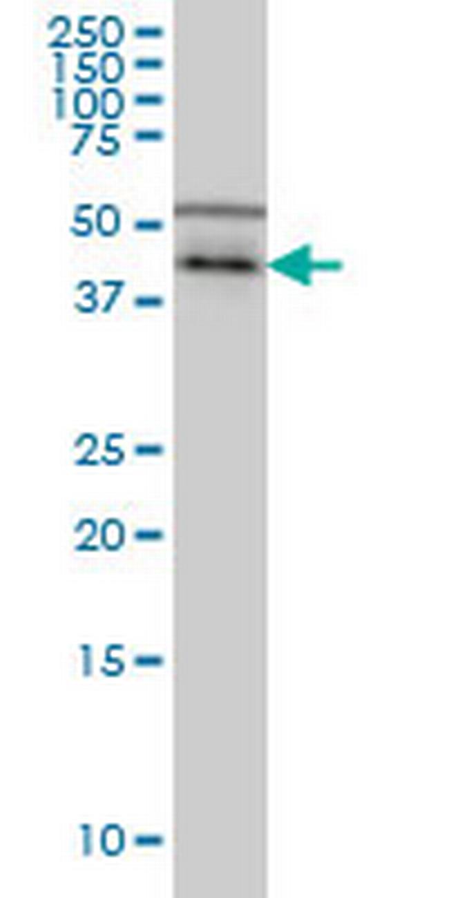 CSNK1G1 Antibody in Western Blot (WB)