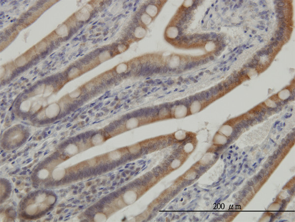 CSNK1G1 Antibody in Immunohistochemistry (Paraffin) (IHC (P))