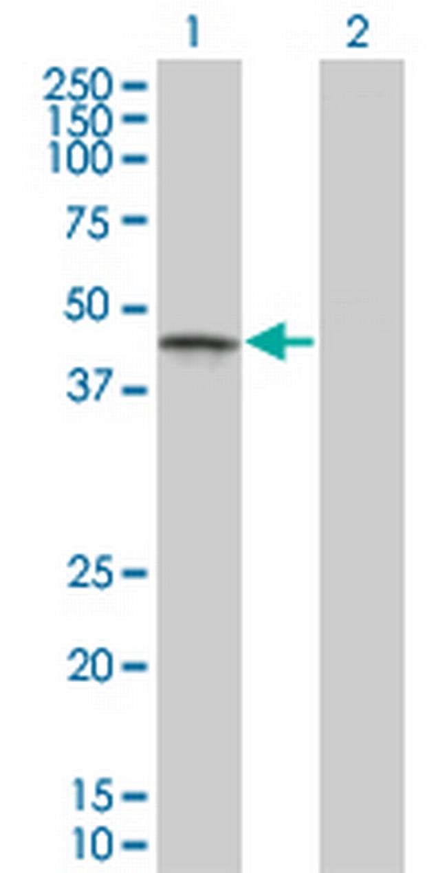 CSNK1G1 Antibody in Western Blot (WB)