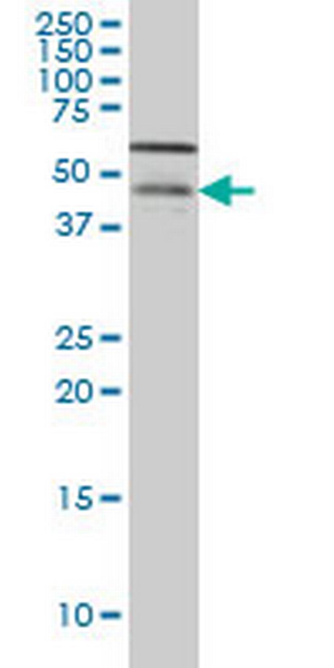 CSNK1G1 Antibody in Western Blot (WB)