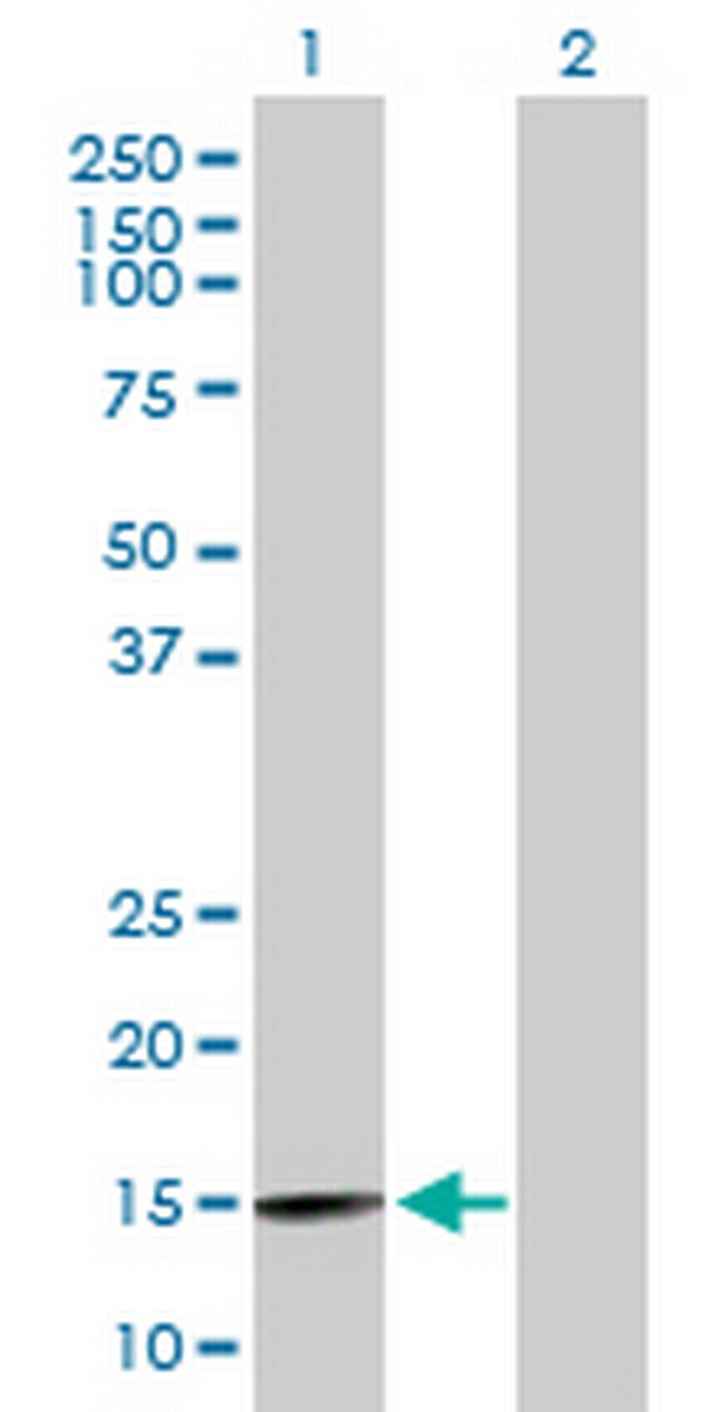 BRWD1 Antibody in Western Blot (WB)