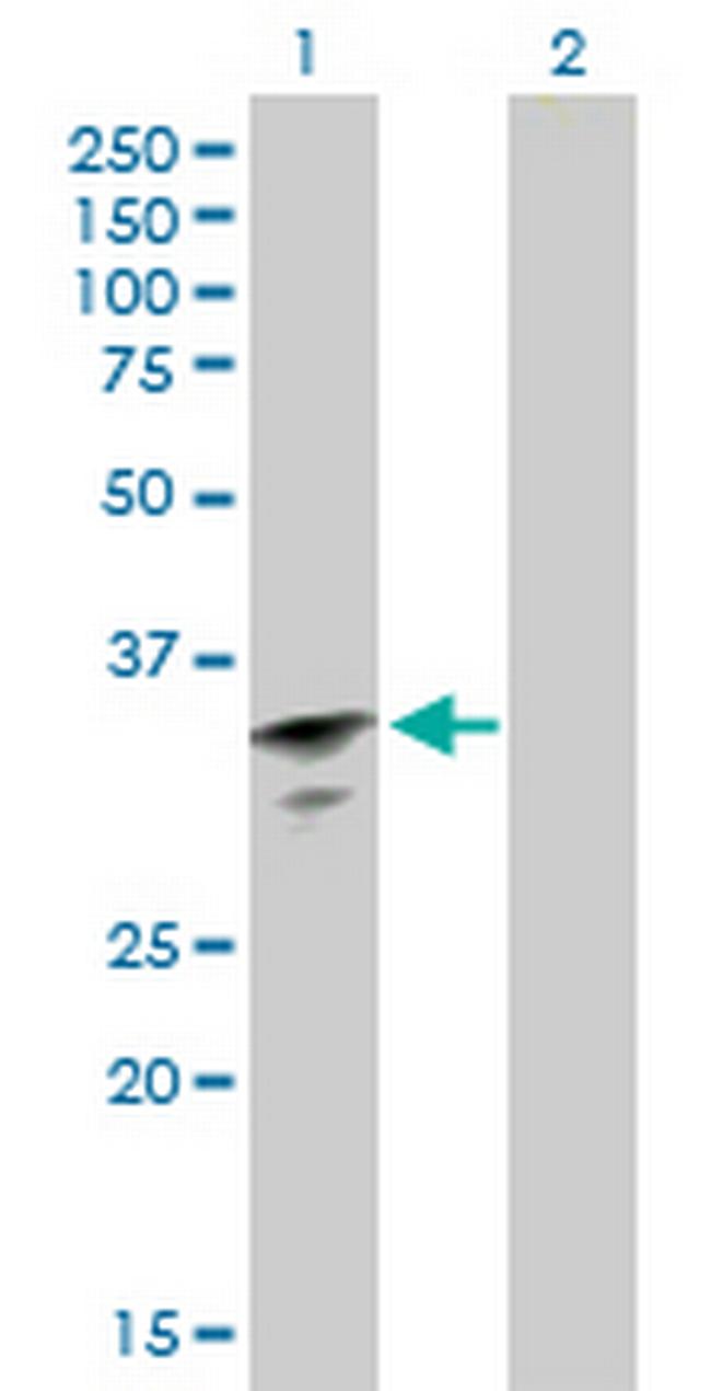 RBM11 Antibody in Western Blot (WB)