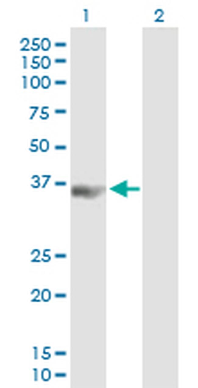 PCBP3 Antibody in Western Blot (WB)