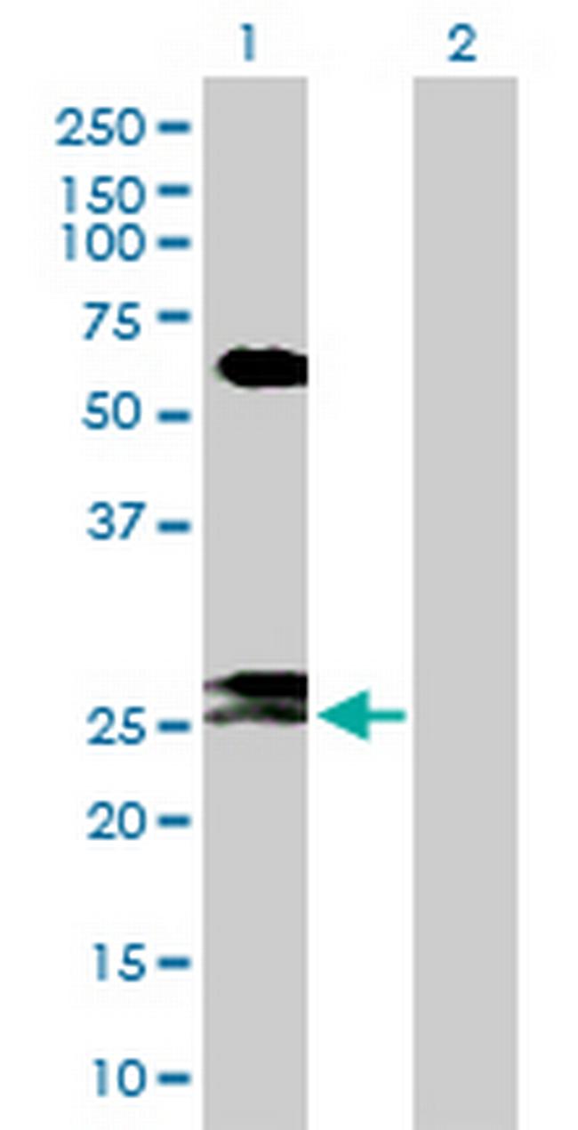FAM3B Antibody in Western Blot (WB)