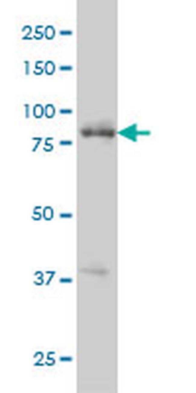 RIPK4 Antibody in Western Blot (WB)