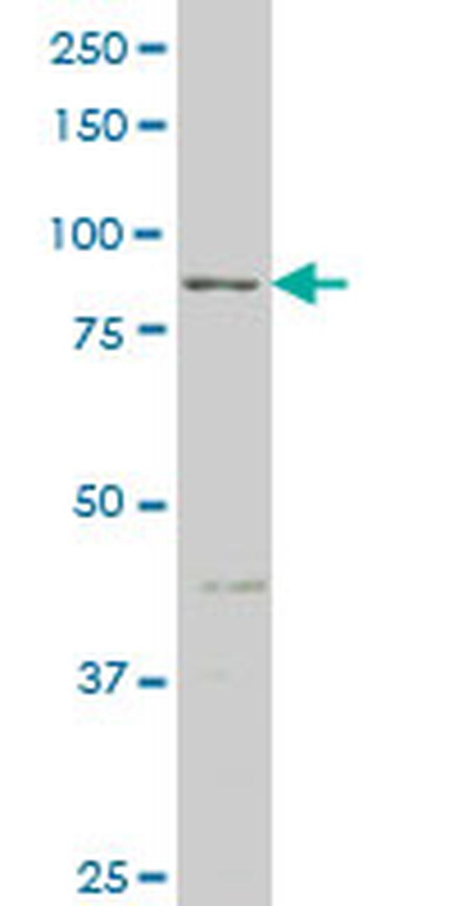 RIPK4 Antibody in Western Blot (WB)