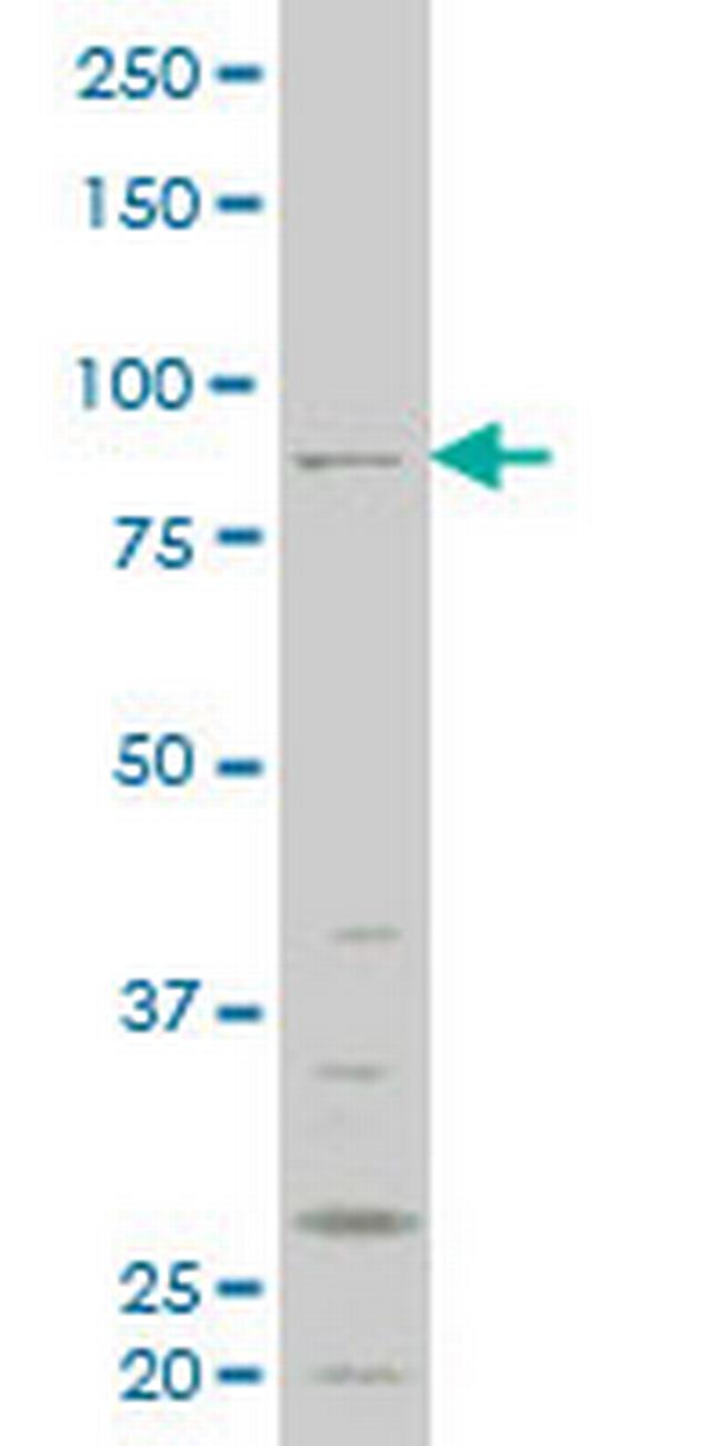 RIPK4 Antibody in Western Blot (WB)