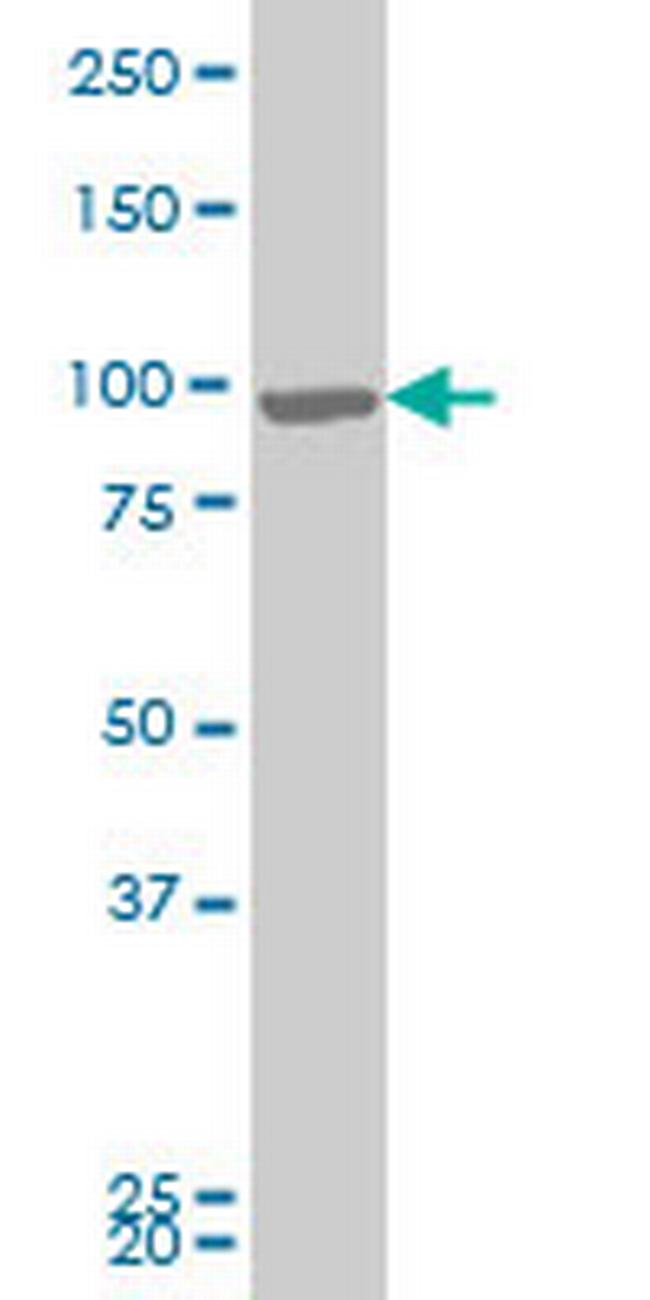 RIPK4 Antibody in Western Blot (WB)