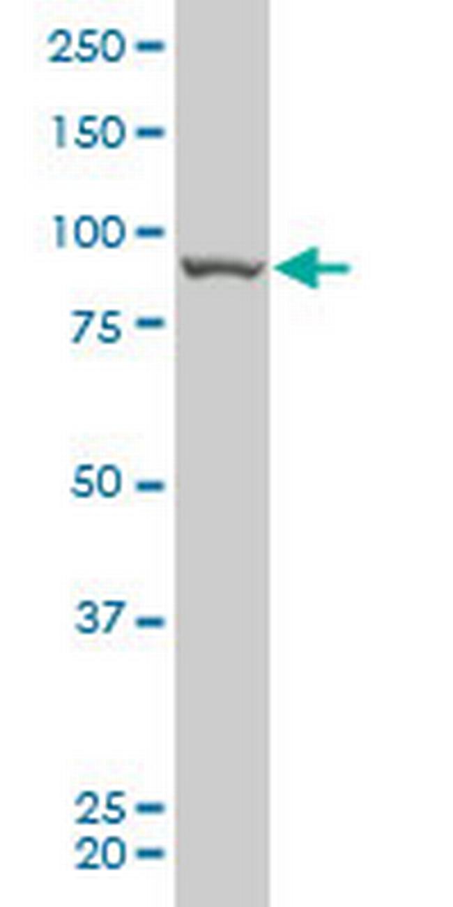 RIPK4 Antibody in Western Blot (WB)