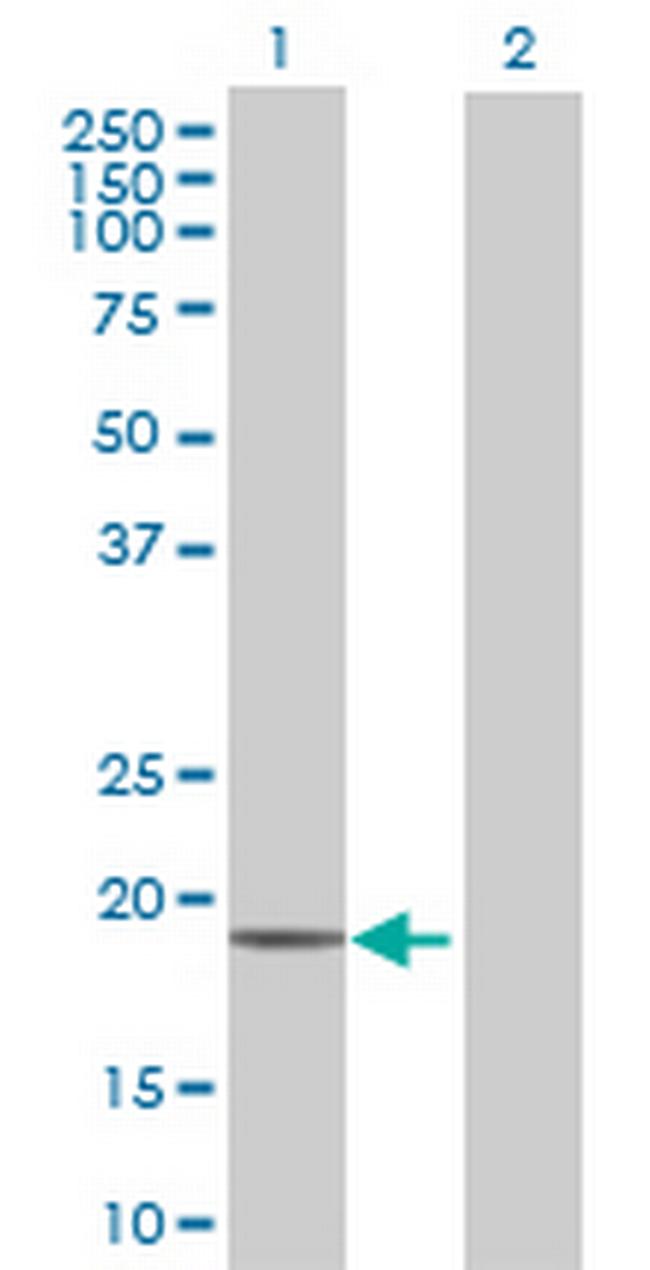 POLE3 Antibody in Western Blot (WB)