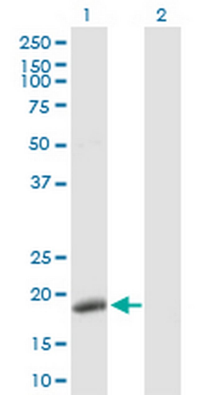 POLE3 Antibody in Western Blot (WB)