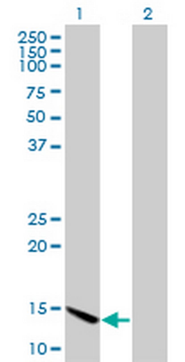 CHRAC1 Antibody in Western Blot (WB)