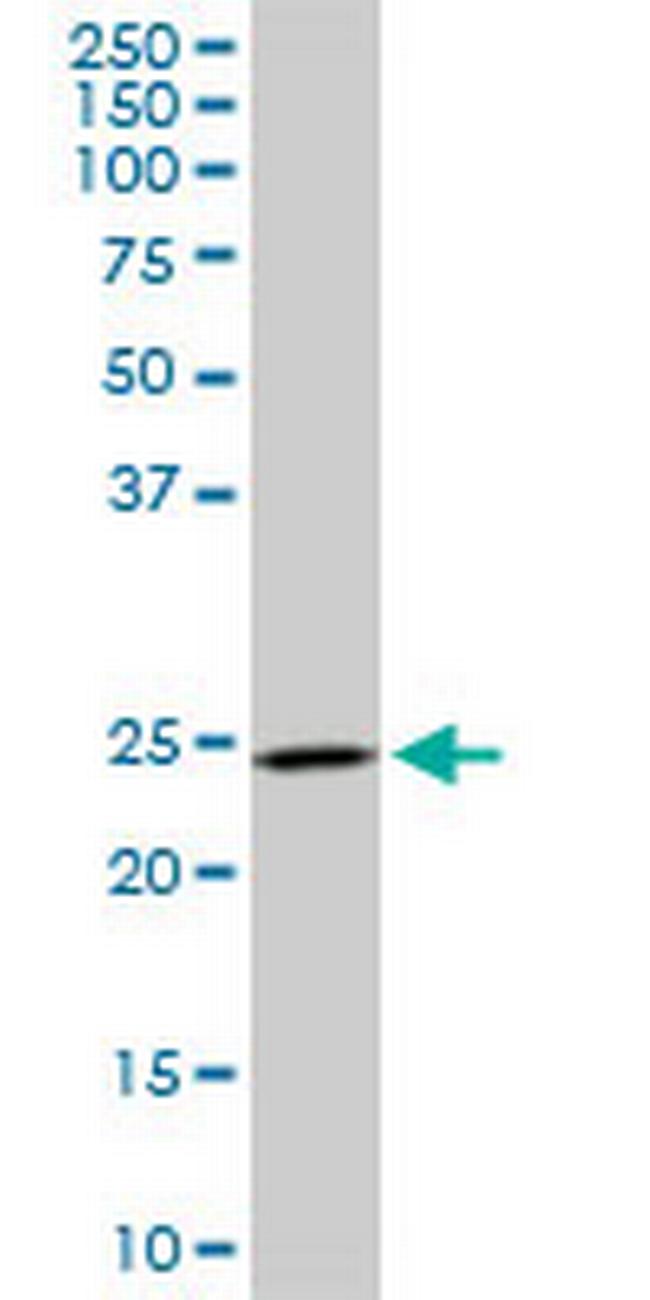 DCUN1D1 Antibody in Western Blot (WB)
