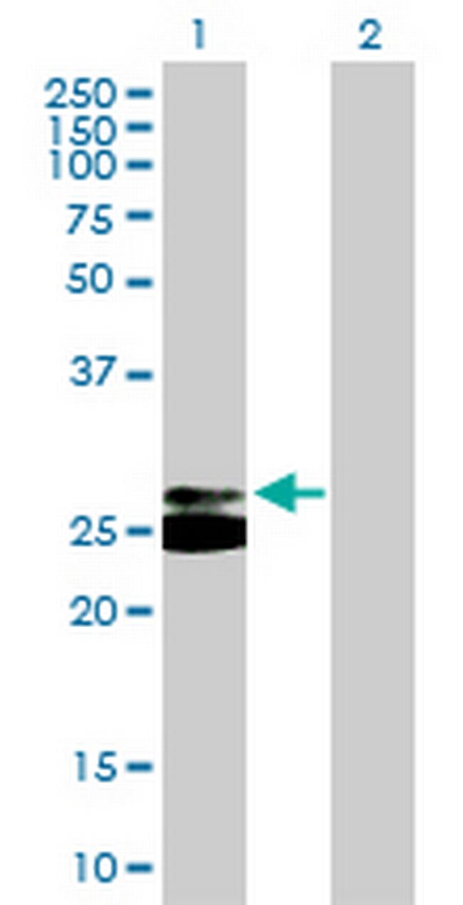 TREM1 Antibody in Western Blot (WB)