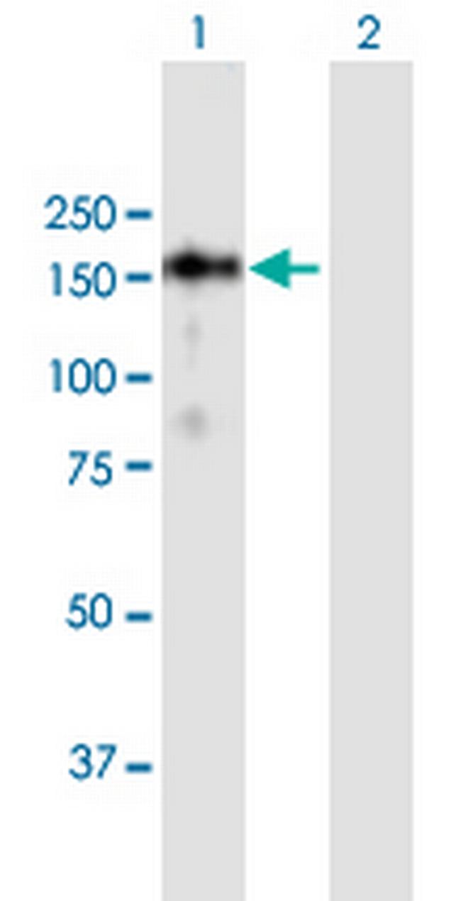 SSH1 Antibody in Western Blot (WB)