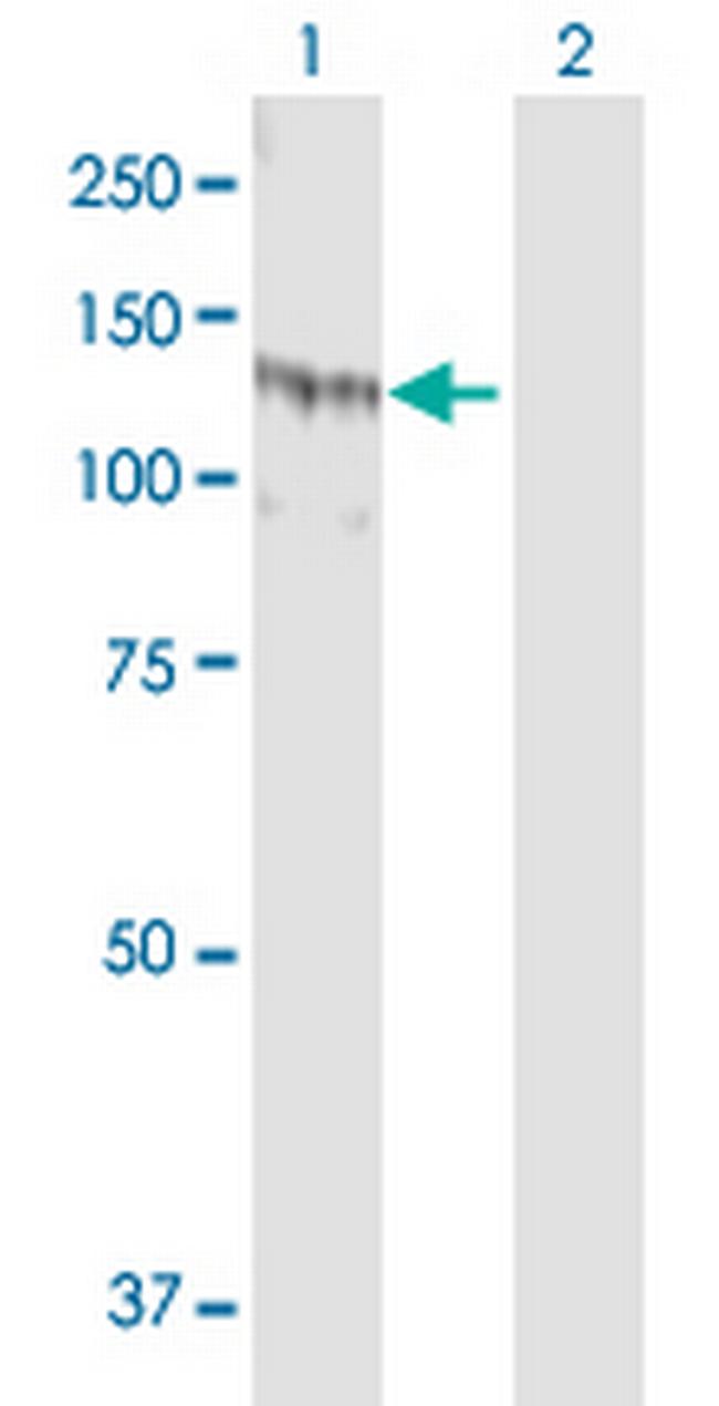 SSH1 Antibody in Western Blot (WB)