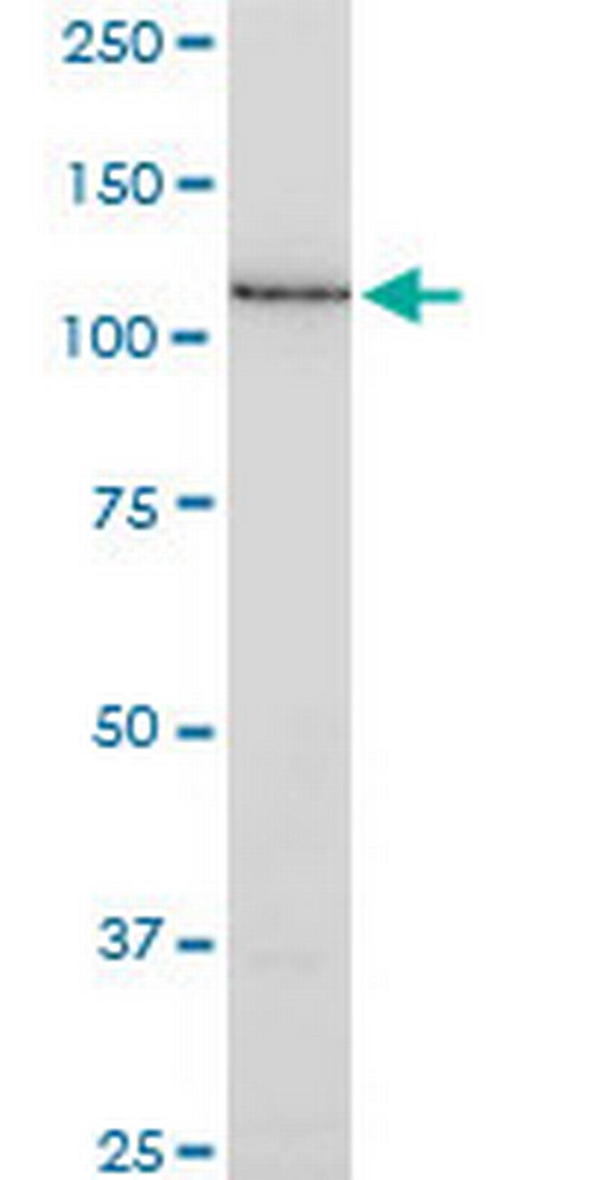 SSH1 Antibody in Western Blot (WB)
