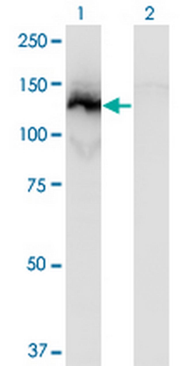 SSH1 Antibody in Western Blot (WB)