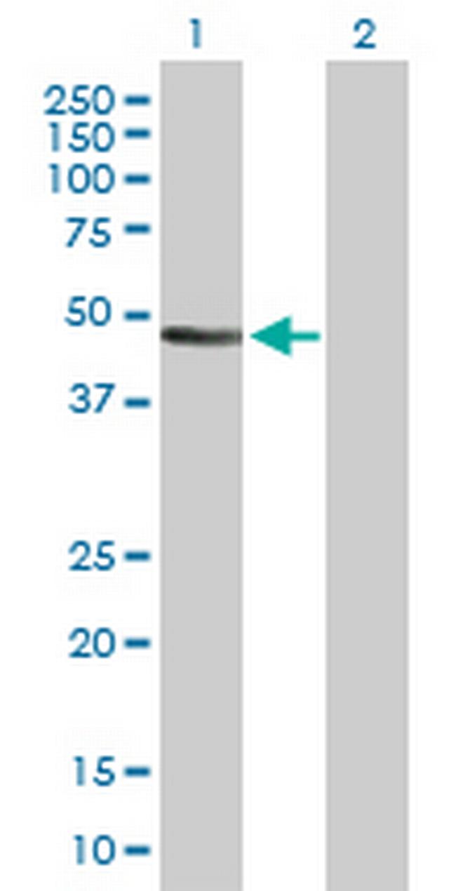 ANLN Antibody in Western Blot (WB)