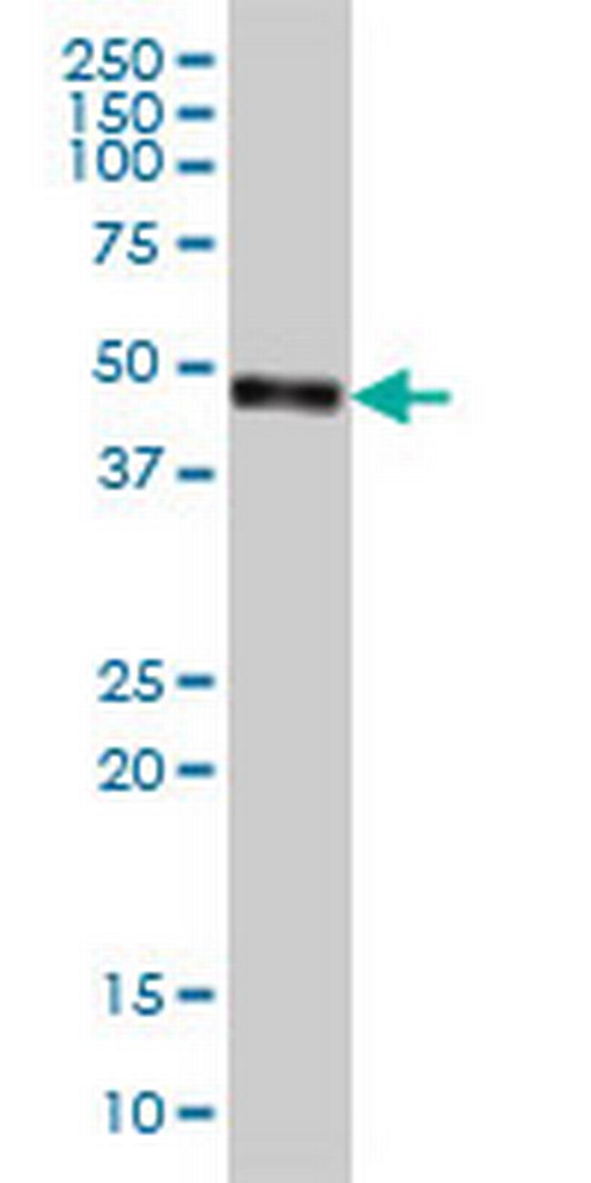 CPVL Antibody in Western Blot (WB)