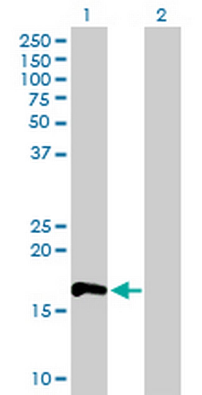 RHOF Antibody in Western Blot (WB)