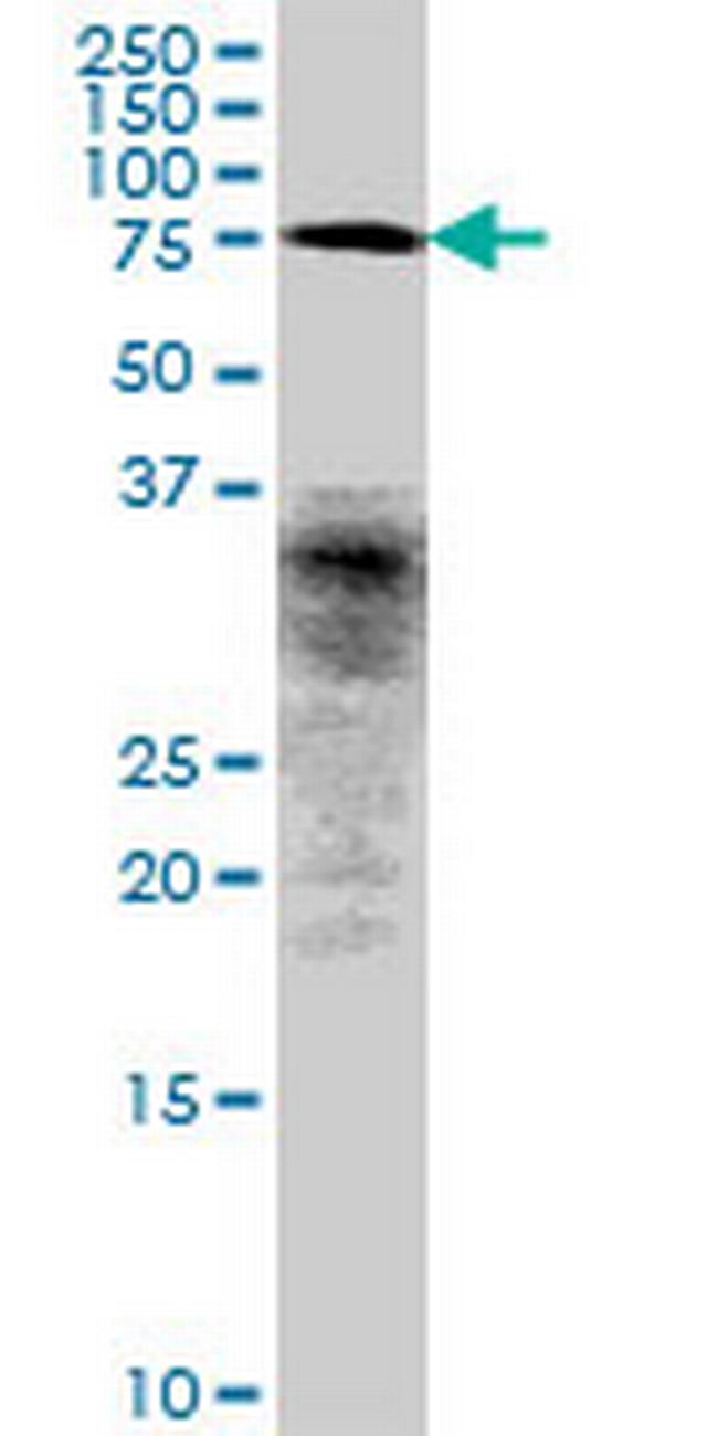 CCDC93 Antibody in Western Blot (WB)