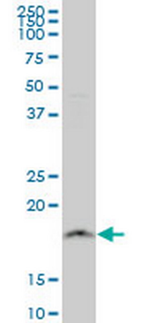 NDUFB11 Antibody in Western Blot (WB)