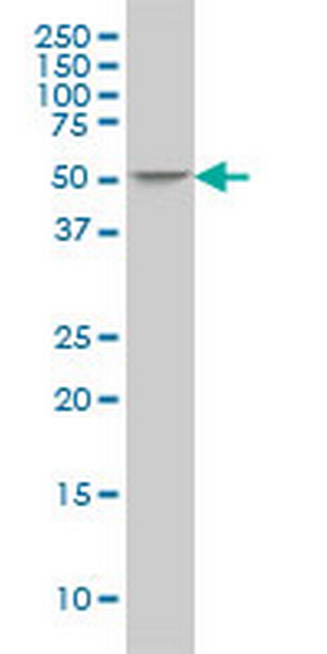 ING3 Antibody in Western Blot (WB)
