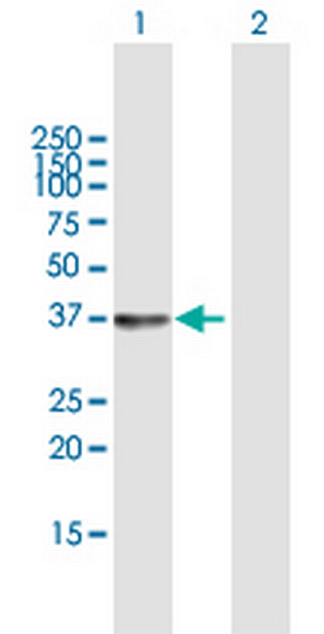 SGTB Antibody in Western Blot (WB)