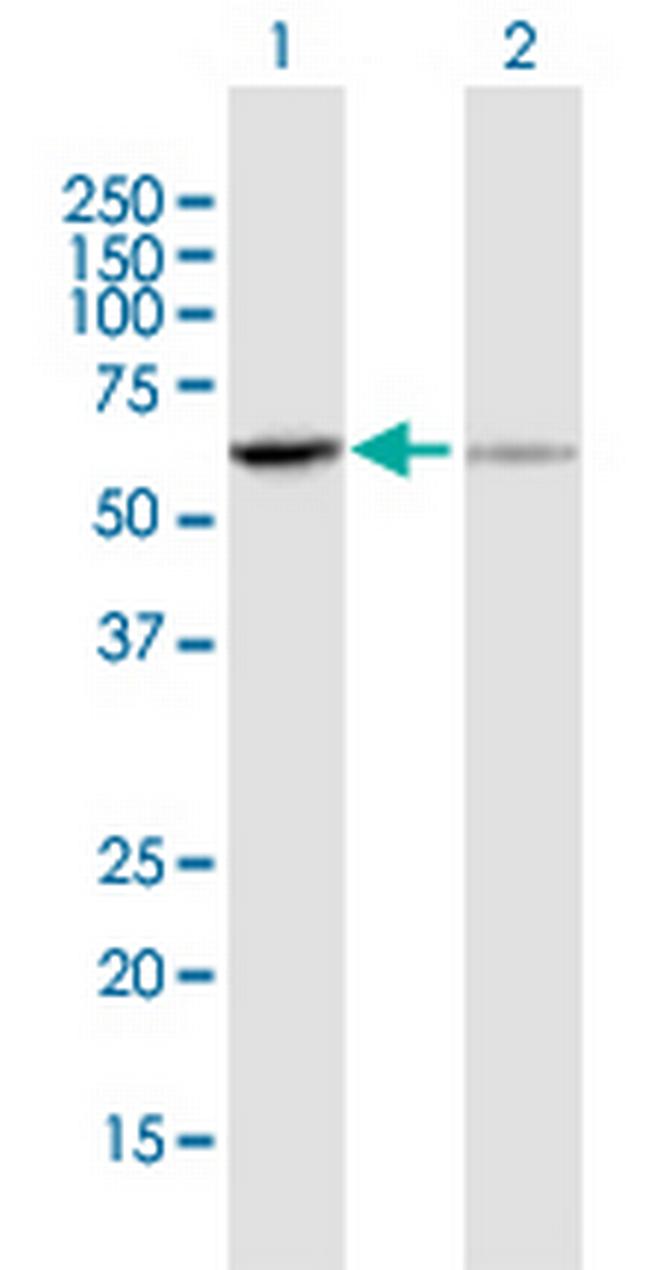 UGT1A6 Antibody in Western Blot (WB)